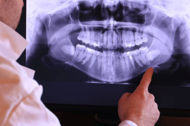 Best Emergency Tooth Extraction in Avenue B And C, AZ